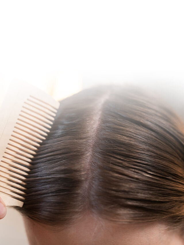 Como cuidar do couro cabeludo: sintomas e como evitar